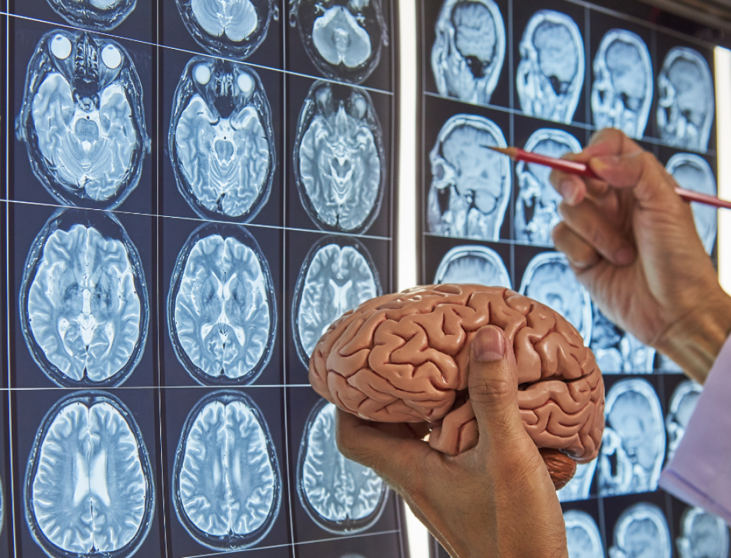 A brain held in front of a imagery of a brain