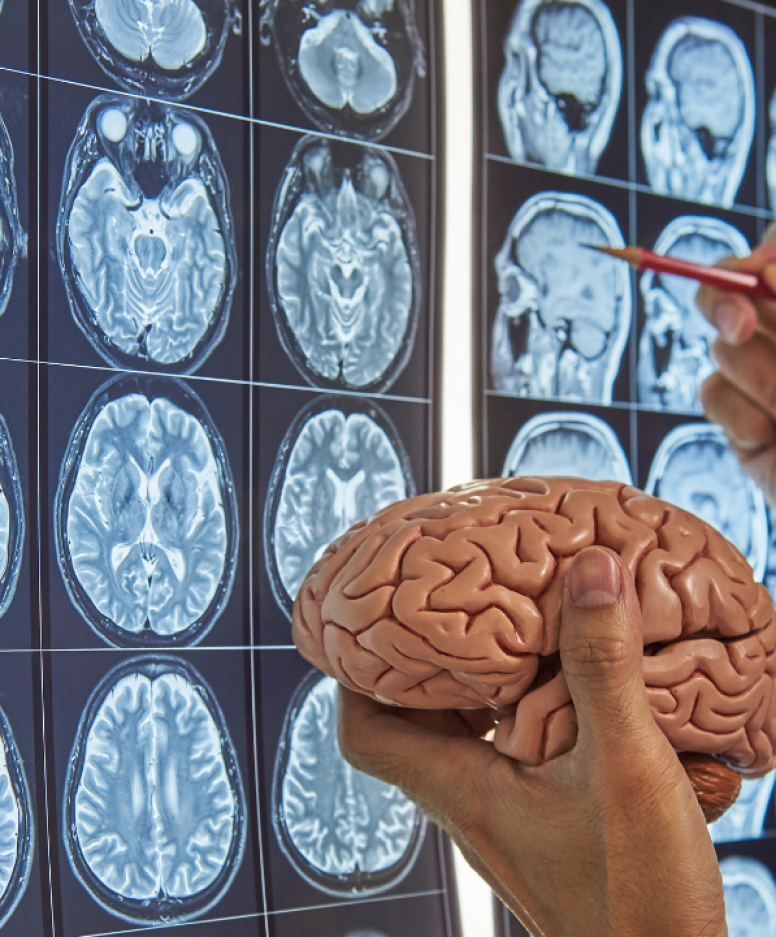 Cyteph Completes Recruitment for Phase I Clinical Trial of CYT-101 in Patients with Recurrent Glioblastoma Multiforme Brain Cancer