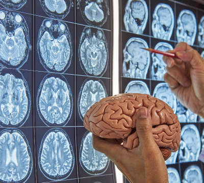 A brain held in front of a imagery of a brain